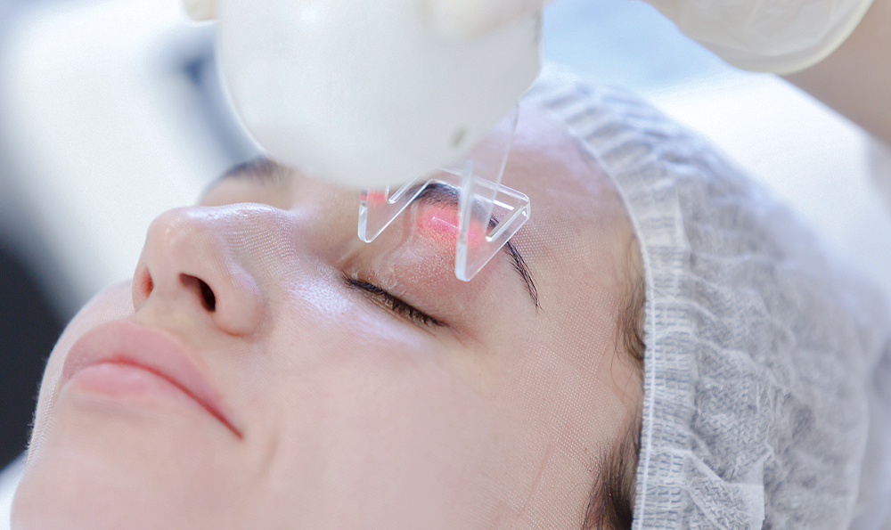 祛火祛痘的水果