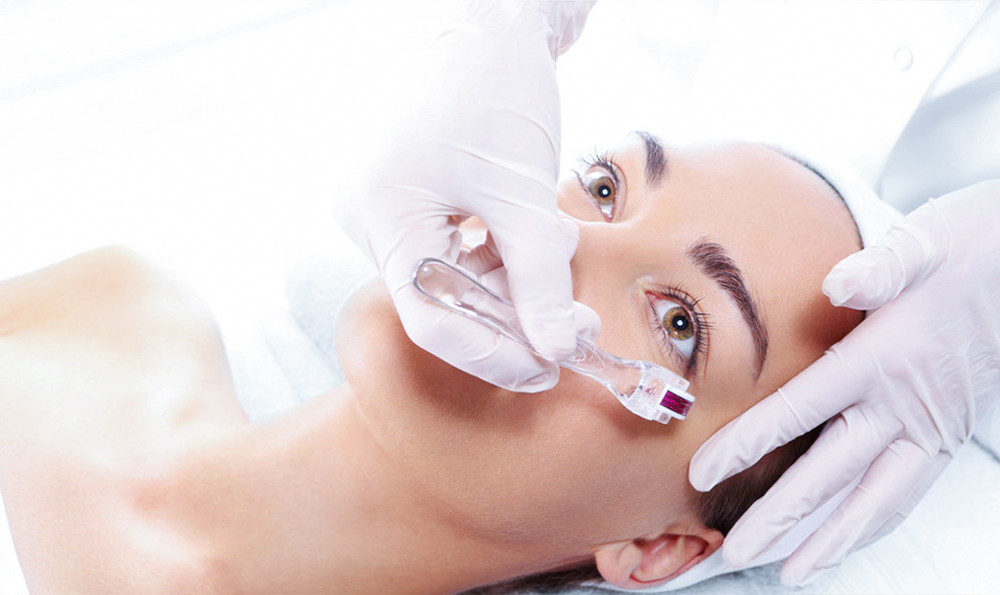 翎雪草本祛痘膏功效