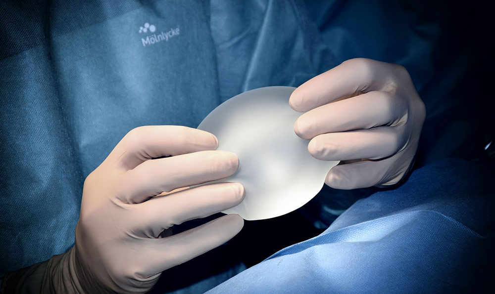 祛痘祛痘印反饋