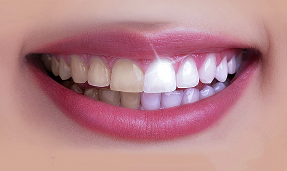 祛痘祛痘印最好的效果用什么