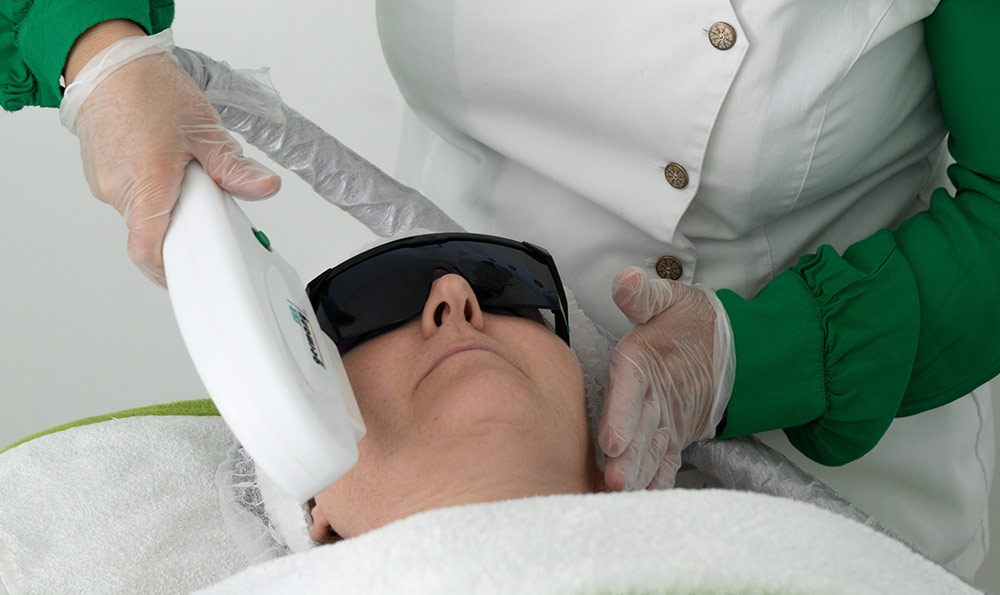 532激光祛斑操作流程