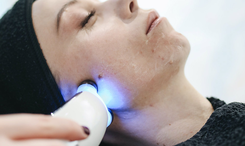 祛痘精油配方茶樹和薰衣草精油