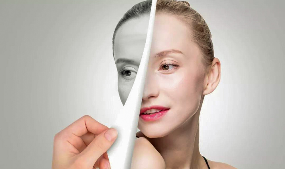 做完激光祛痘印后注意事項