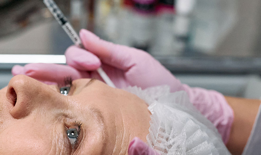 羽素祛痘產(chǎn)品可以去痘印嗎